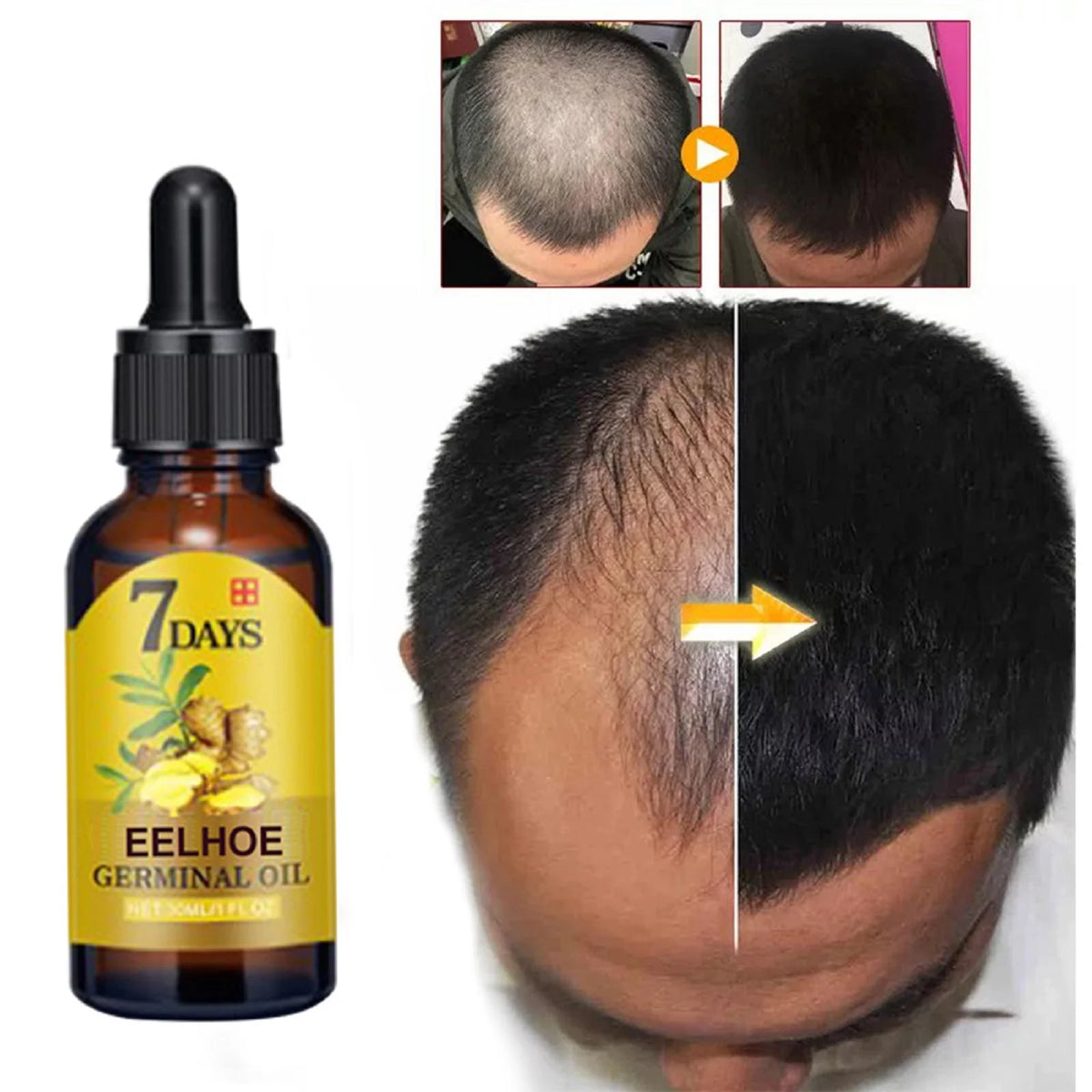 Ginger Hair Growth Oil Strengthening Scalp Nourishing Hair Roots