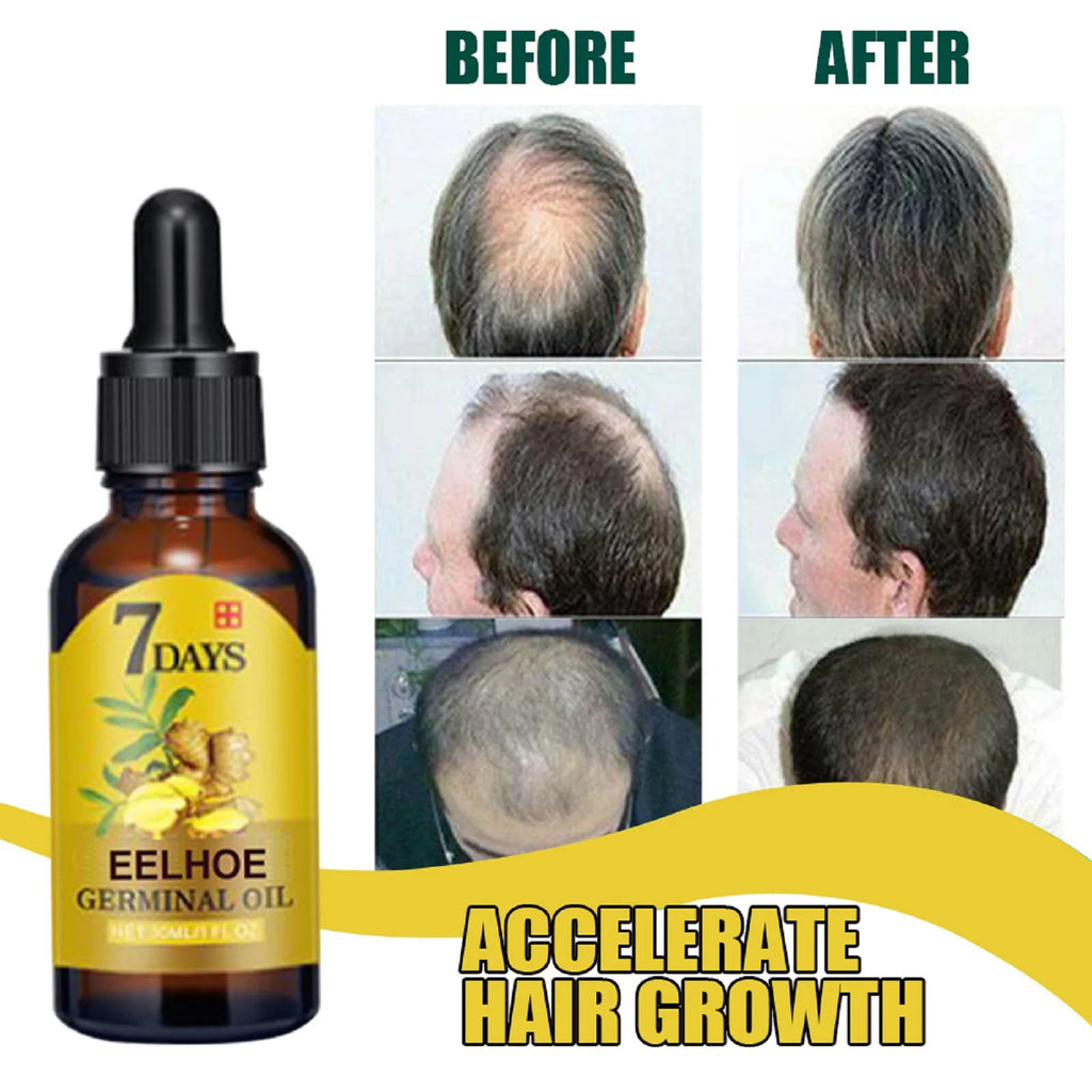 Ginger Hair Growth Oil Strengthening Scalp Nourishing Hair Roots